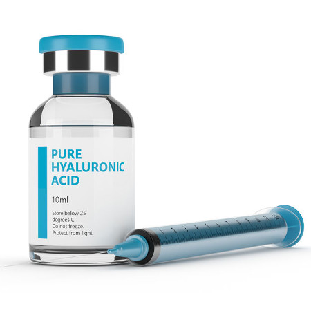 Hyaluronic Acid Injection, knee replacement alternatives