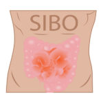 sibo-small-intestine-bacterial-overgrowth