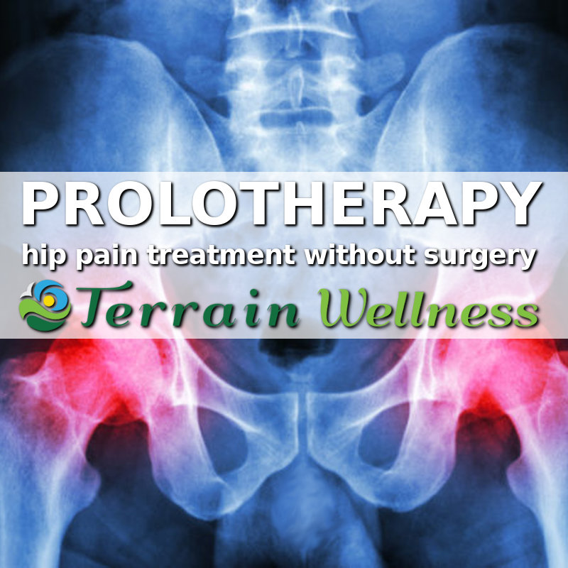 Prolo for hip pain