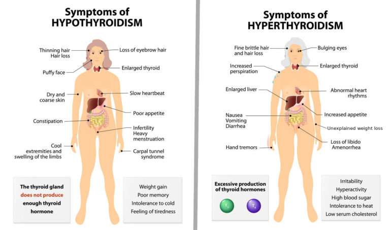 Hypothyrodism Vs Hyperthyroidism Naturopathic Primary Care Doctors