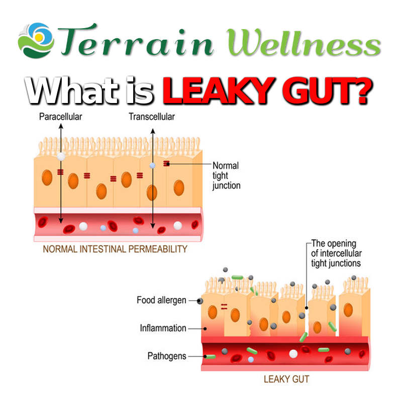 what is leaky gut?