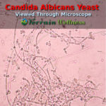 candida albicans under a microscope