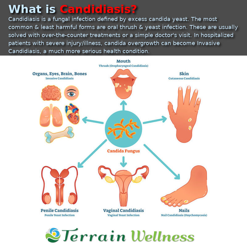 candidiasis definition and infographic oral thrush yeast infection invasive candidiasis