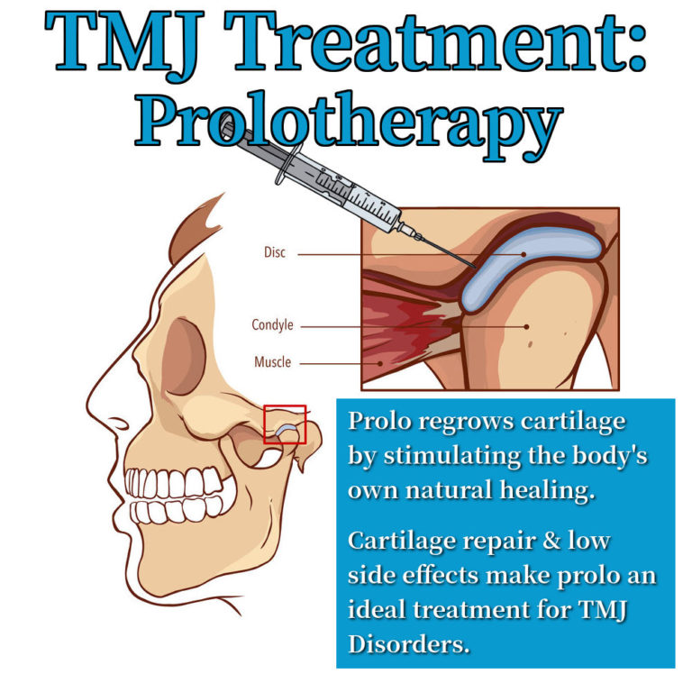 TMJ Treatment - Naturopathic Primary Care Doctors Portland Oregon